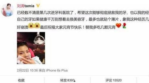 多少明星做牙冠了,众多明星纷纷加入“美牙”行列