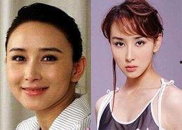 整容失败了的明星图片,美丽代价与警示