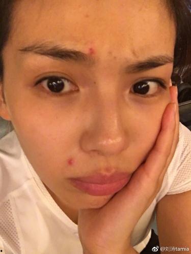 痘痘多的明星,揭秘痘痘频发背后的护肤秘籍